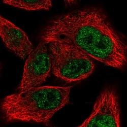 MED9 Antibody, Novus Biologicals:Antibodies:Primary Antibodies